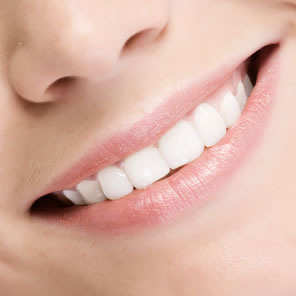Sourire blanchiment des dents par laser